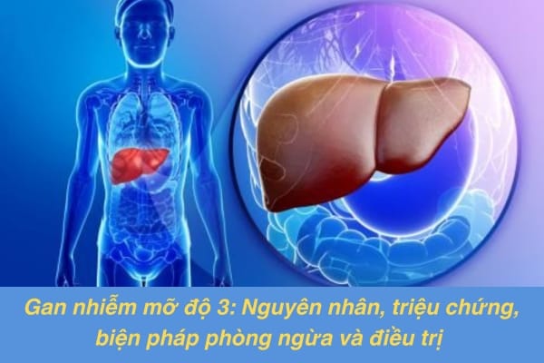 gan-nhiem-mo-do-3