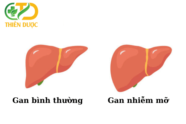 Gan-to-do-gan-nhiem-mo