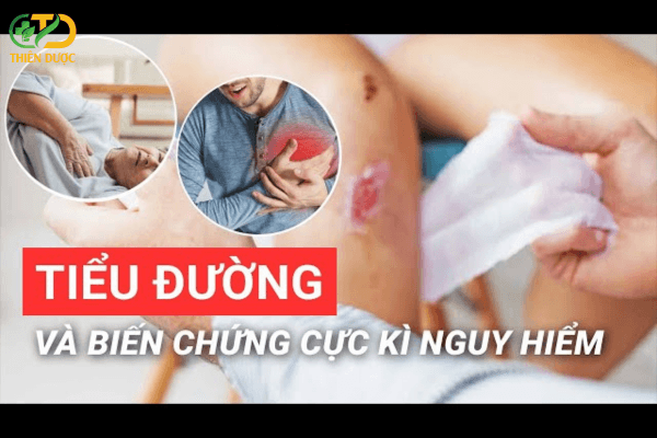 Các phương pháp hỗ trợ bệnh tiểu đường phổ biến
