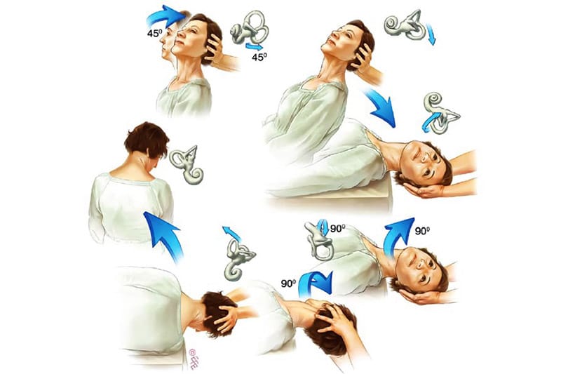 5 bài tập chữa rối loạn tiền đình bạn nên tìm hiểu ngay