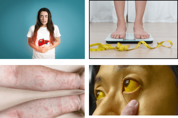 Điều trị viêm gan B có khỏi hoàn toàn được không?