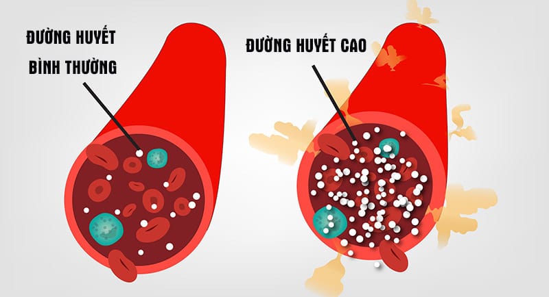 tieu-duong-co-chua-duoc-khong