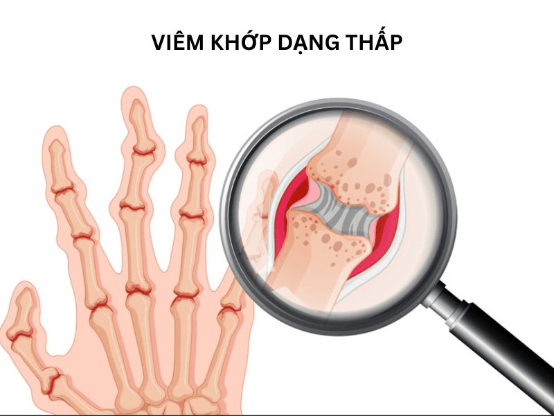 Ai không nên dùng đông trùng hạ thảo?